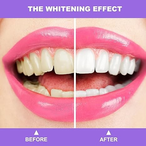 Purple Toothpaste for Teeth Whitening,Teeth Whitening Booster,Tooth Stain Removal,Teeth Whitener,Purple Whitening Toothpaste